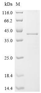 Recombinant Eisenia fetida Lysenin