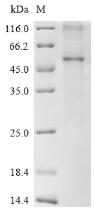 Recombinant Human Metalloreductase STEAP2 (STEAP2)