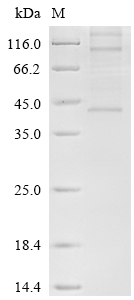 Recombinant Human Chemerin-like receptor 1 (CMKLR1)