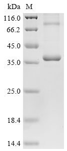 Recombinant Mouse STEAP1 protein (Steap1)