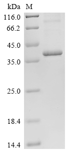 Recombinant Human STEAP1 protein (STEAP1)