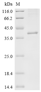 Recombinant Macaca mulatta Ferric oxidoreductase domain-containing protein (STEAP1)
