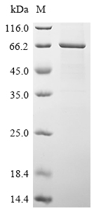 Recombinant Human Galactocerebrosidase (GALC)