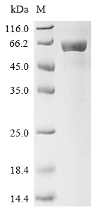 Recombinant Pongo abelii Neurofilament light polypeptide (NEFL), partial