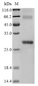 Recombinant Human 3-oxo-5-alpha-steroid 4-dehydrogenase 1 (SRD5A1)