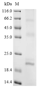 Recombinant Rat Claudin-5 (Cldn5)