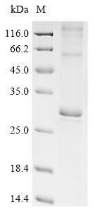 Recombinant Mouse E3 ubiquitin-protein ligase MARCH5 (Marchf5)