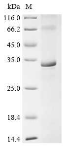 Recombinant Mouse E3 ubiquitin-protein ligase MARCH5 (Marchf5)