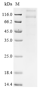 Recombinant Human Taste receptor type 1 member 2 (TAS1R2)