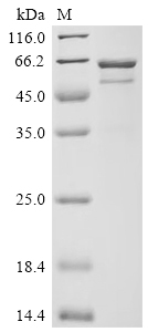 Recombinant Streptococcus pyogenes serotype M1 C5a peptidase (scpA), partial