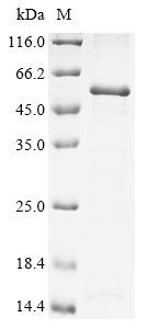 Recombinant Human Proto-oncogene c-Fos (Fos)