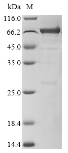 Recombinant Human Insulin-like growth factor 1 receptor (IGF1R), partial, Biotinylated