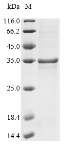 Recombinant Vaccinia virus Cell surface-binding protein OPG105 (D8L), partial