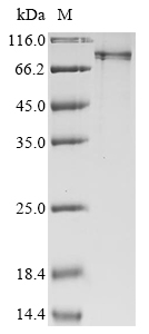 Recombinant Human E3 ubiquitin-protein ligase RNF168 (RNF168)