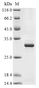 Recombinant Mouse Metalloproteinase inhibitor 3 (Timp3)