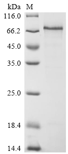 Recombinant Human Thrombomodulin (THBD), partial