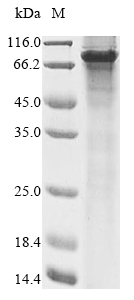 Recombinant Human Forkhead box protein N1 (FOXN1)