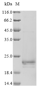 Recombinant Influenza A virus Matrix protein 2 (M), partial