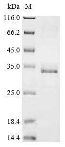 Recombinant Human Podocin (NPHS2), partial