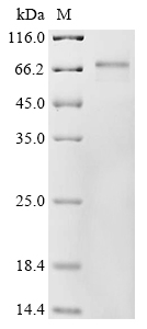 Recombinant Human RNA-binding protein MEX3A (MEX3A)