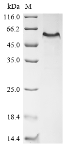 Recombinant Mouse EGF-containing fibulin-like extracellular matrix protein 1 (Efemp1)