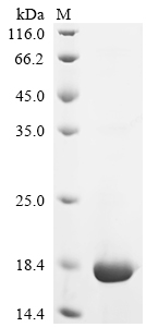 Recombinant Human Alpha-synuclein (SNCA), partial