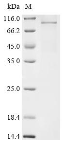 Recombinant Mouse Desmocollin-3 (Dsc3)