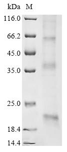 Recombinant Human Claudin-11 (CLDN11)