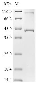 Recombinant Dictyostelium discoideum Putative ZDHHC-type palmitoyltransferase 8 (DDB_G0280329)