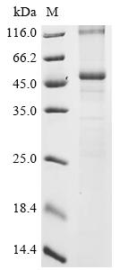 Recombinant Human Lysocardiolipin acyltransferase 1 (LCLAT1)