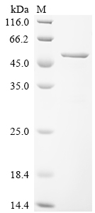 Recombinant Human Paraneoplastic antigen Ma2 (PNMA2), partial