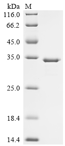 Recombinant Rat Uricase (Uox)