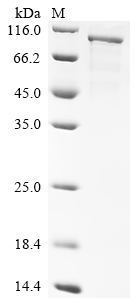 Recombinant Human Schlafen family member 11 (SLFN11)