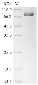 Recombinant Human Interleukin-1 receptor-associated kinase-like 2 (IRAK2)