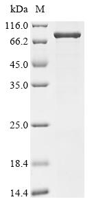 Recombinant Human Junctional protein associated with coronary artery disease (JCAD), partial