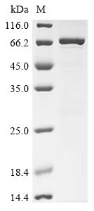 Recombinant Human Creatine kinase M-type (CKM)
