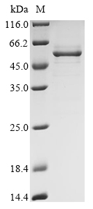 Recombinant Infectious bronchitis virus Spike glycoprotein S1 subunit (S1), partial