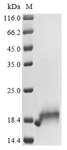 Recombinant Mouse Protein S100-B (S100b)