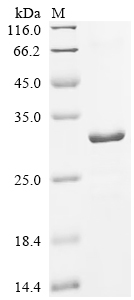 Recombinant Mouse Tolloid-like protein 1 (Tll1), partial