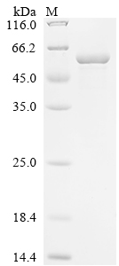 Recombinant Human Kinesin-1 heavy chain (KIF5B), partial