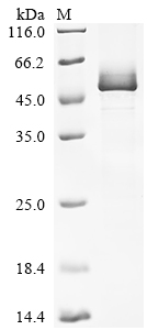 Recombinant Human Lipoyl synthase, mitochondrial (LIAS)