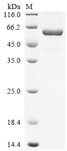 Recombinant Human 7-alpha-hydroxycholest-4-en-3-one 12-alpha-hydroxylase (CYP8B1), partial