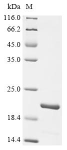 Recombinant Human Aquaporin-5 (AQP5), partial