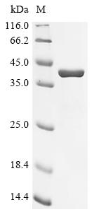 Recombinant Human Carbonic anhydrase 6 (CA6)