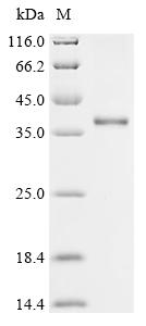 Recombinant Rat Histamine H1 receptor (Hrh1), partial