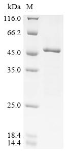 Recombinant Coxiella burnetii Hypothetical membrane spanning protein (CBU_1863), partial