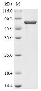 Recombinant Human Nuclear factor NF-kappa-B p105 subunit (NFKB1), partial