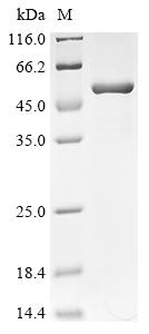 Recombinant Human Succinyl-CoA ligase [ADP-forming] subunit beta, mitochondrial (SUCLA2)
