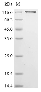 Recombinant Aquifex aeolicus DNA mismatch repair protein MutS (mutS), Biotinylated