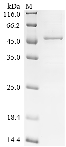 Recombinant Human Acetyl-CoA acetyltransferase,mitochondrial (ACAT1)